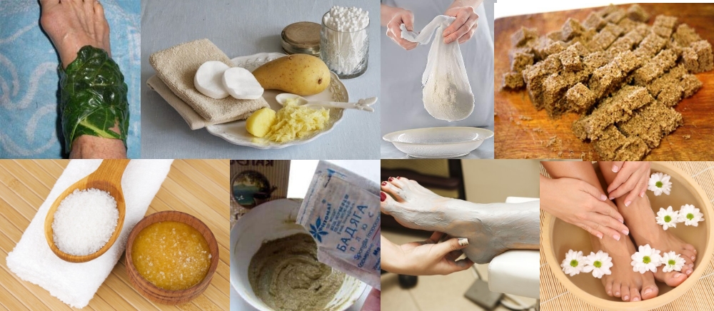 Народные средства для лечения связок голеностопа Народные средства для лечения связок голеностопа