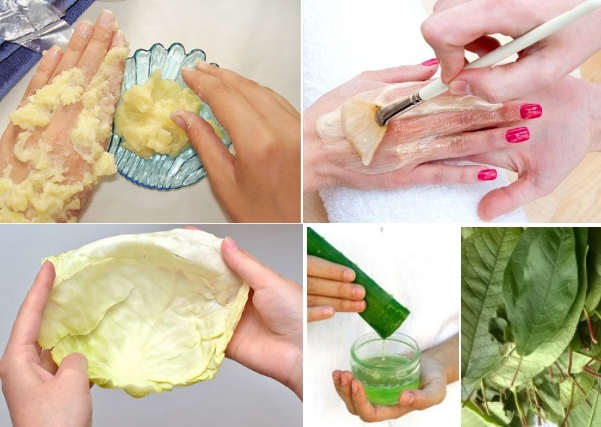 Аппликации для лечения щелкающего пальца Аппликации для лечения щелкающего пальца