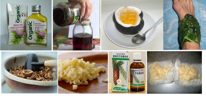 Народные средства при радикулите Народные средства при радикулите