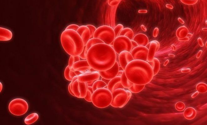 Нарушение притока крови