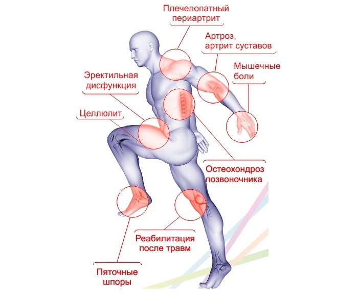 Назначение УВТ Назначение УВТ