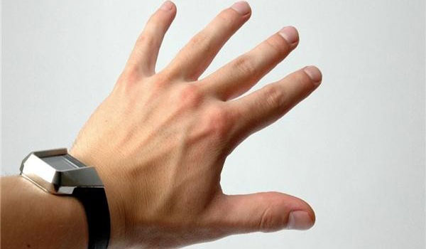 Нестабильность большого пальца руки Нестабильность большого пальца руки