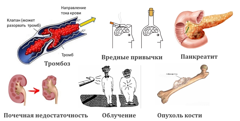 Нетравматические причины некроза Нетравматические причины некроза