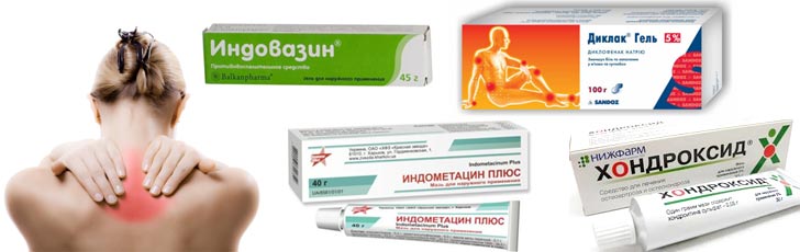 НПВС мази при остеохондрозе НПВС мази при остеохондрозе