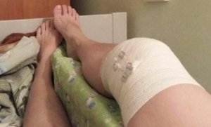 Обеспечение покоя колена