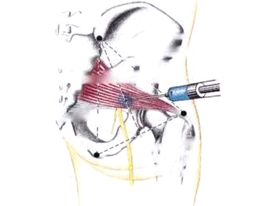 Обезболивающие инъекции Обезболивающие инъекции