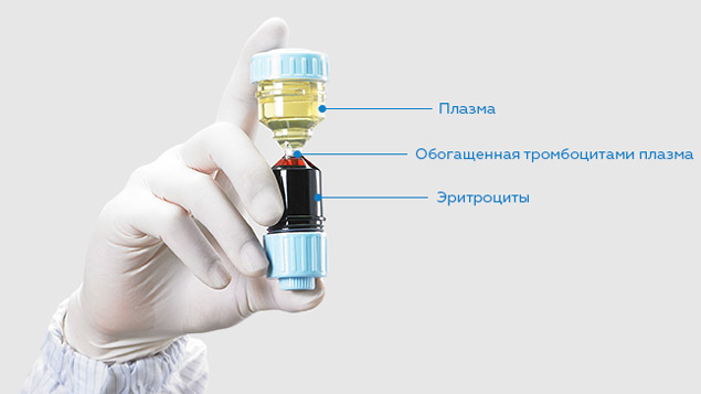 Обогащенная плазма Обогащенная плазма