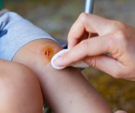 Избегание области ссадин