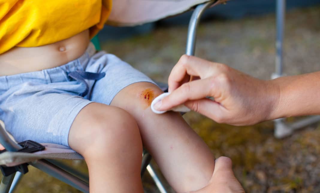 Обработка ссадины антисептиком