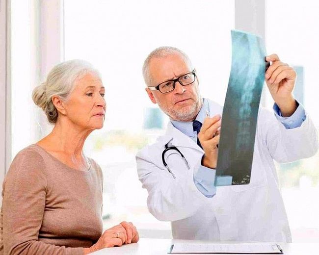 Обращение к врачу при болезни Бехтерева Обращение к врачу при болезни Бехтерева