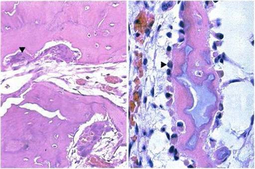 Процесс окостенения мягких тканей Процесс окостенения мягких тканей