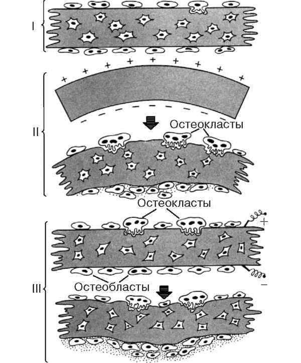 Формирование клеток костной ткани при терапии Формирование клеток костной ткани при терапии
