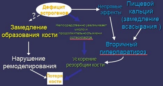 Остеопороз из-за дефицита эстрогенов Остеопороз из-за дефицита эстрогенов