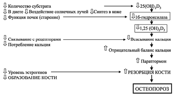 Патогенез сенильного остеопороза второго типа Патогенез сенильного остеопороза второго типа