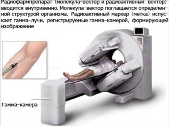 Описание сцинтиграфии Описание сцинтиграфии