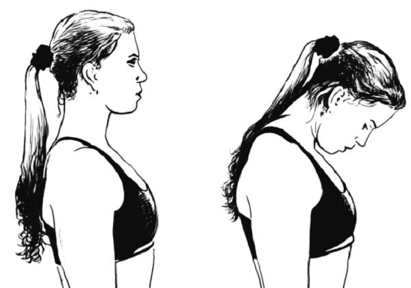 Осторожное выполнение движений при остеохондрозе Осторожное выполнение движений при остеохондрозе