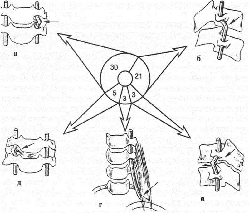 Ощущение кома при передавливании артерий Ощущение кома при передавливании артерий