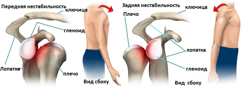 Передняя и задняя нестабильность плечевого сустава Передняя и задняя нестабильность плечевого сустава