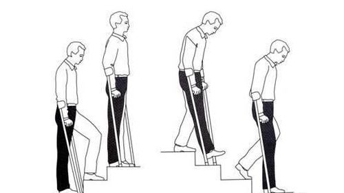 Передвижение на костылях по лестнице Передвижение на костылях по лестнице