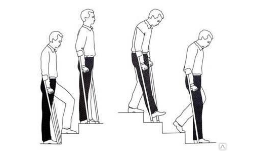 Передвижение на костылях Передвижение на костылях