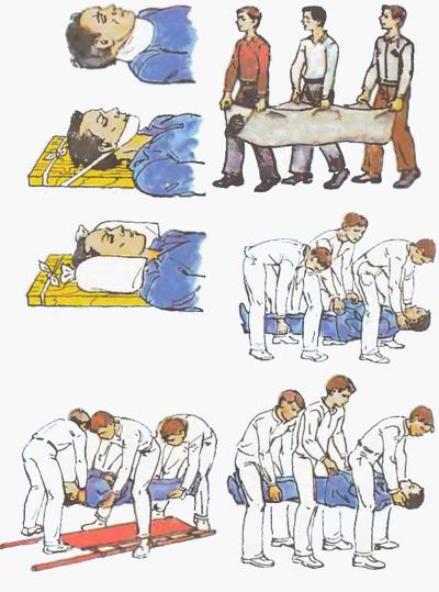 Переноска при травме позвоночника Переноска при травме позвоночника