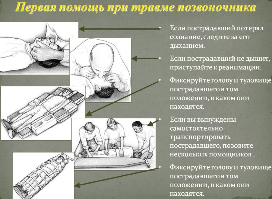 Оказание первой помощи Оказание первой помощи