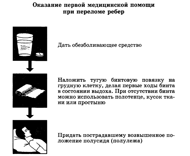 Первая помощь при переломе ребер