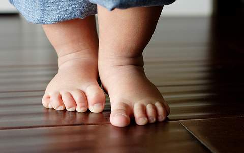 Выявление вальгусной деформации при первых шагах ребенка Выявление вальгусной деформации при первых шагах ребенка