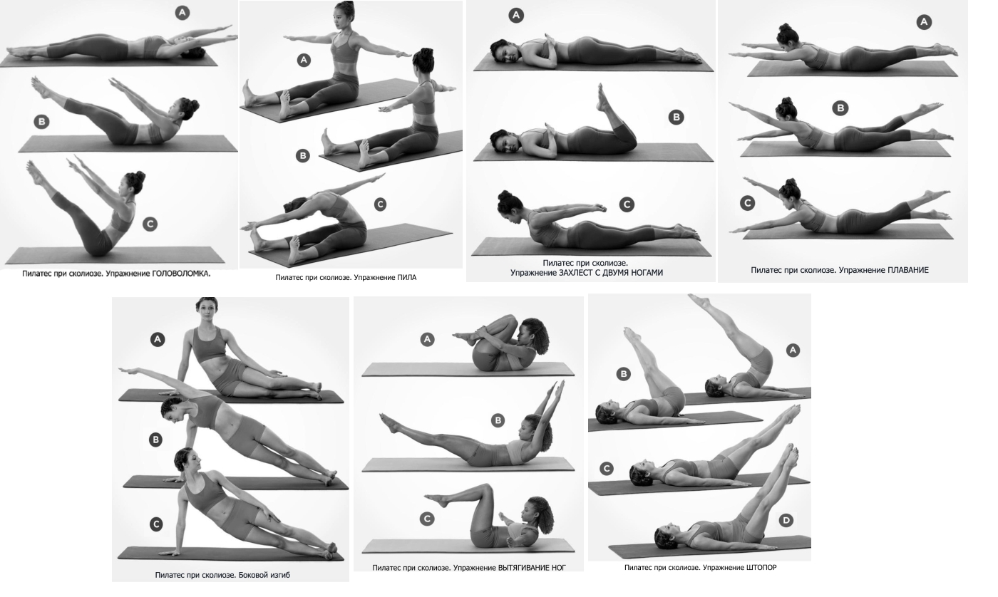 Пилатес при сколиозе Пилатес при сколиозе