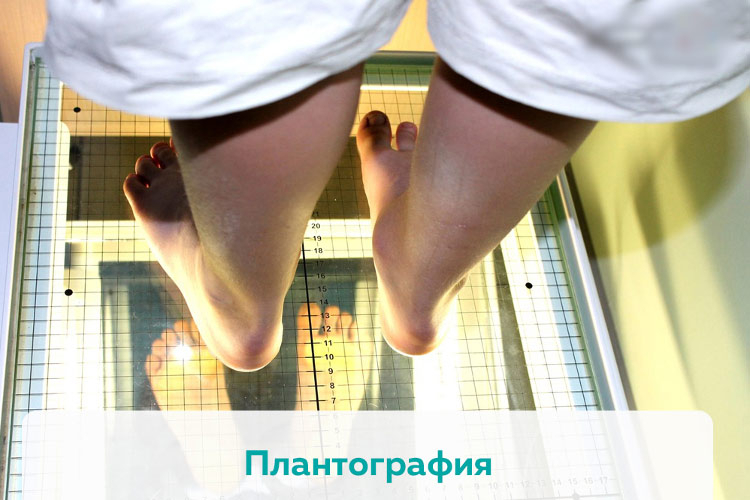 Плантография