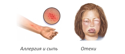 Побочные действия Discus compositum Побочные действия Discus compositum