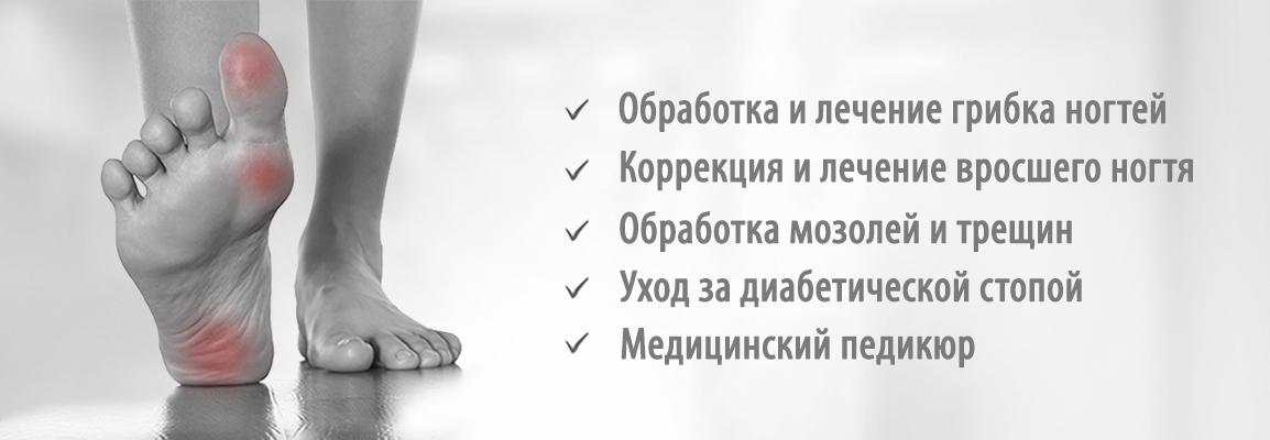 Подологические процедуры Подологические процедуры