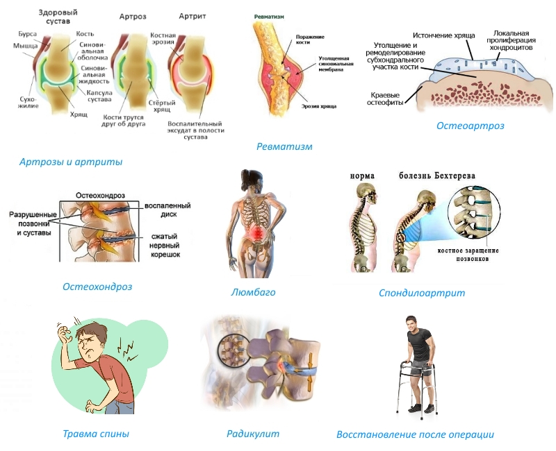 Показания для Фламакса Показания для Фламакса