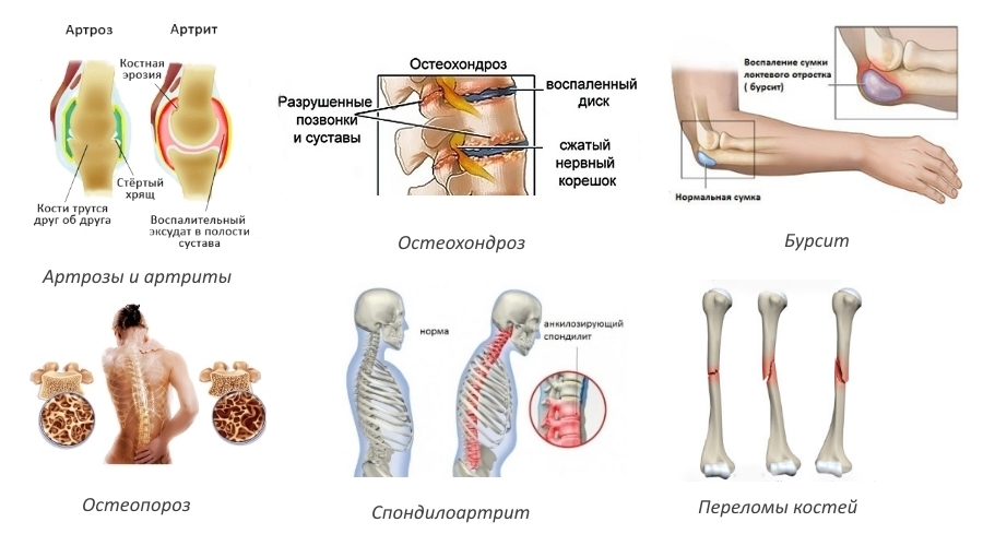 Показания для приема Протекты Показания для приема Протекты