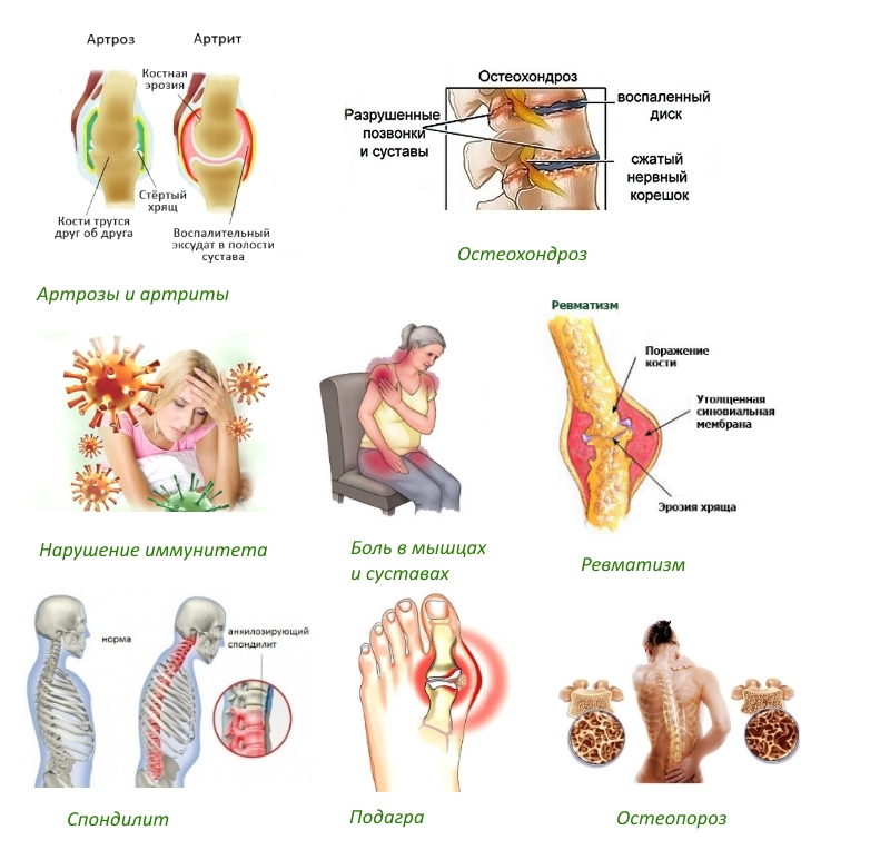Показания для Сустанорма Показания для Сустанорма