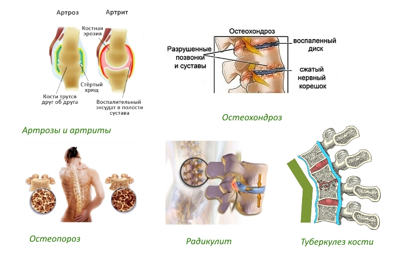 Показания для приема Тазана Показания для приема Тазана
