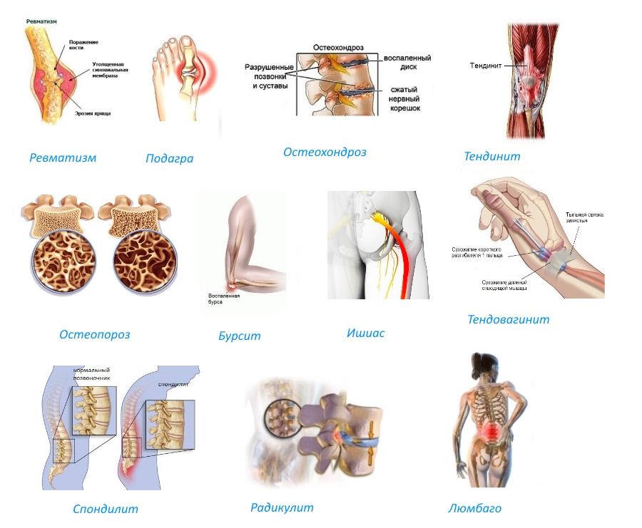 Показания для Нимулида Показания для Нимулида