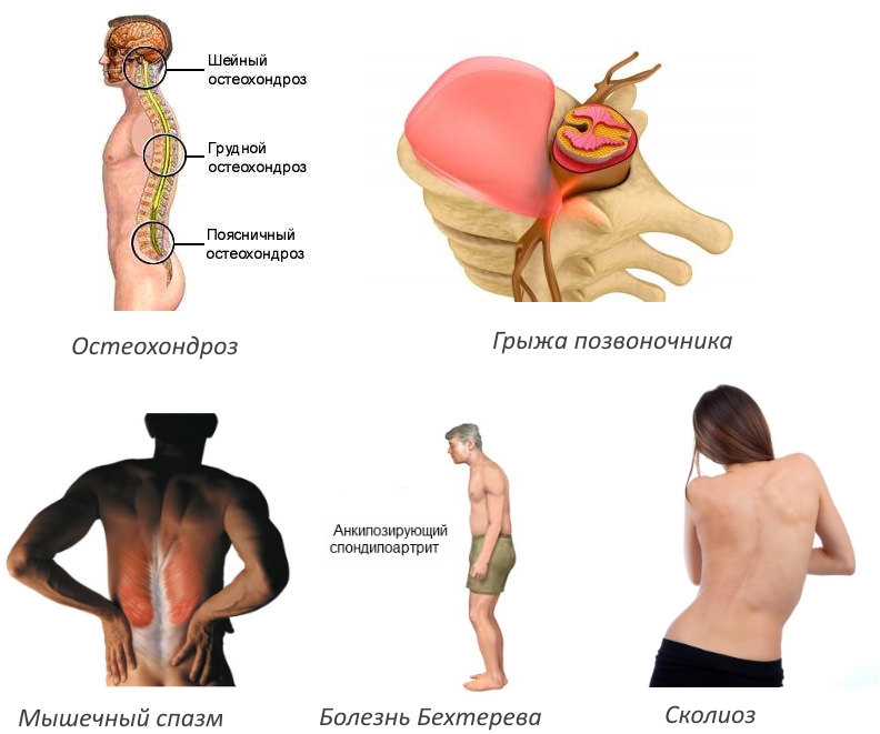 Показания для использования качелей Яловицына Показания для использования качелей Яловицына
