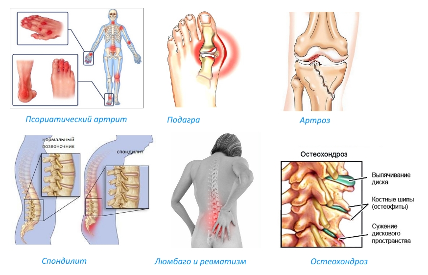 Показания для крема Долгит Показания для крема Долгит