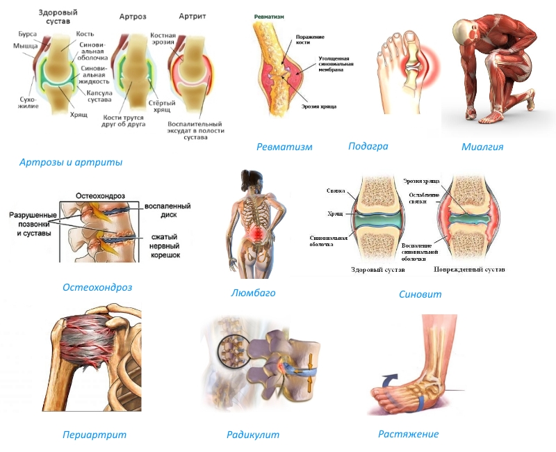 Показания для применения мази Долгит Показания для применения мази Долгит