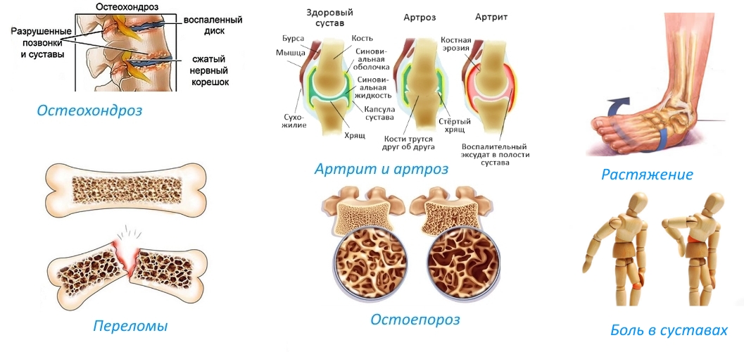 Показания для приема Остео би-флекс Показания для приема Остео би-флекс