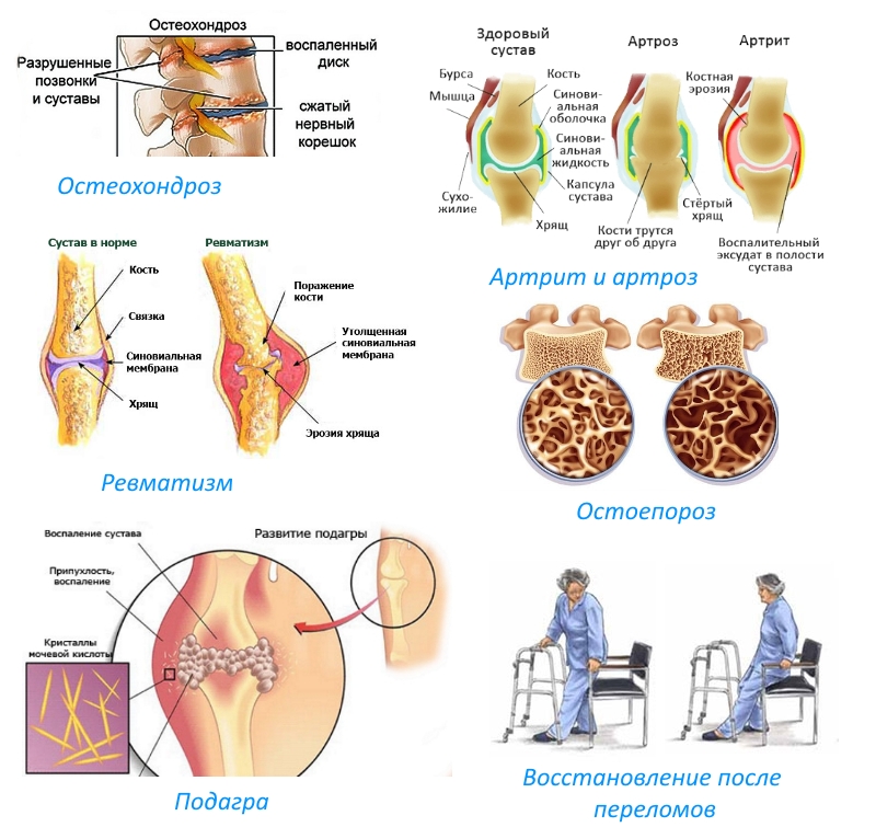 Показания к приему Хондромарина Показания к приему Хондромарина