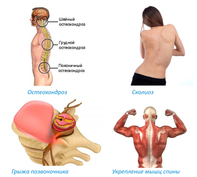 Показания к использованию Показания к использованию
