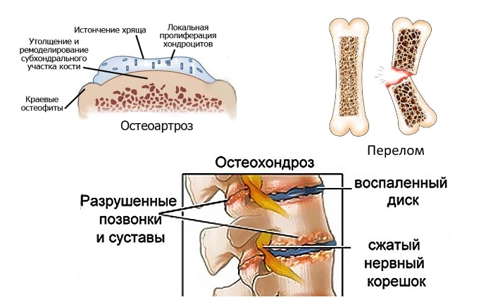 Показания к Хондрогарду Показания к Хондрогарду