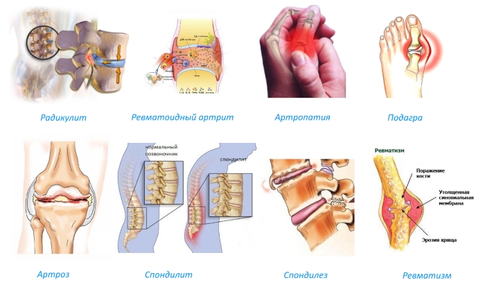 Показания для использования Диклоберла Показания для использования Диклоберла