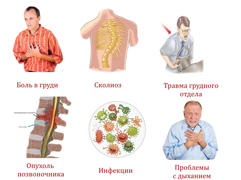 Показания к рентгену грудного отдела позвоночника Показания к рентгену грудного отдела позвоночника