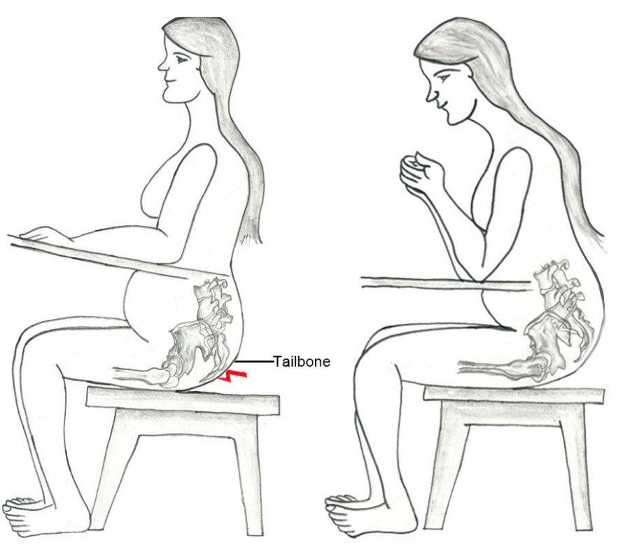 Положение крестца при беременности Положение крестца при беременности