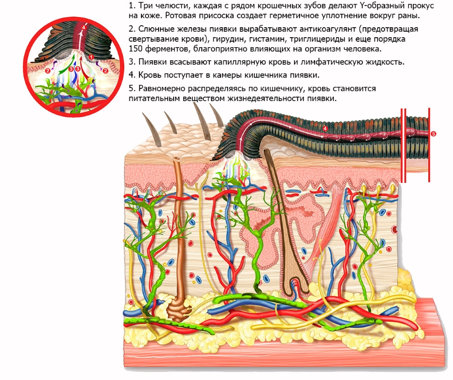 Польза пиявок для организма Польза пиявок для организма