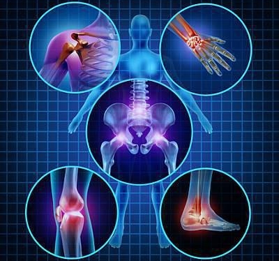 Боли в суставах Боли в суставах