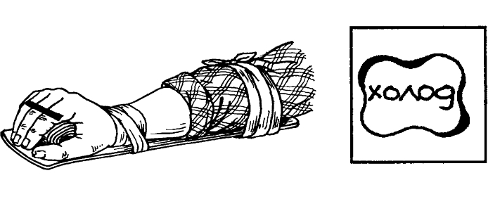 Помощь при переломе кисти Помощь при переломе кисти